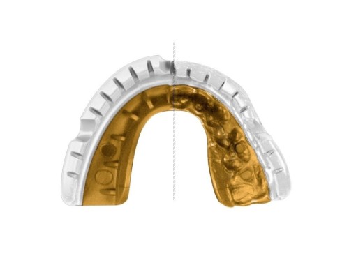 Капа Opro Gold Braces під брекети White/Gold (102506004) (Gold_Braces_Wh/Gold)
