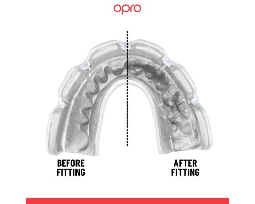 Капа Opro Instant Single Colour Braces Clear (102522007) (Instant_Braces_Clear)