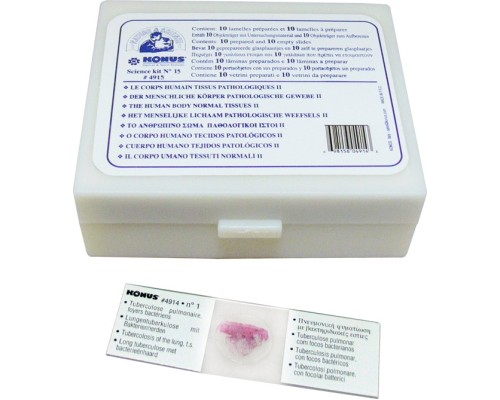 Набір мікропрепаратів Konus Патологічні тканини людського тіла, частина II 10 шт (4915)